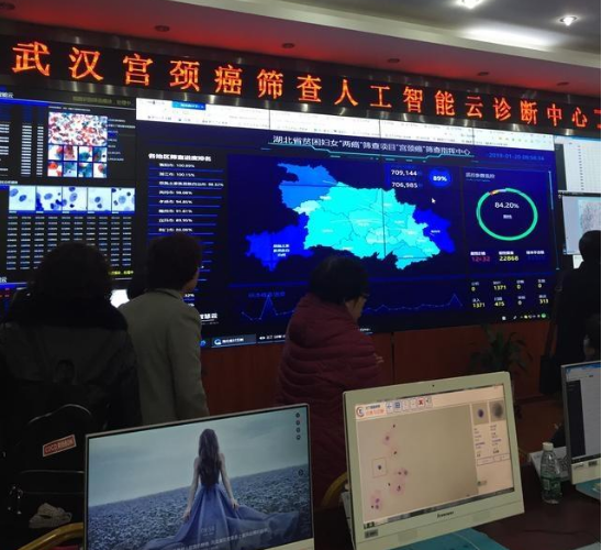 利用机器人进行宫颈癌筛查工作 速率比原先人工筛查快了至少4倍