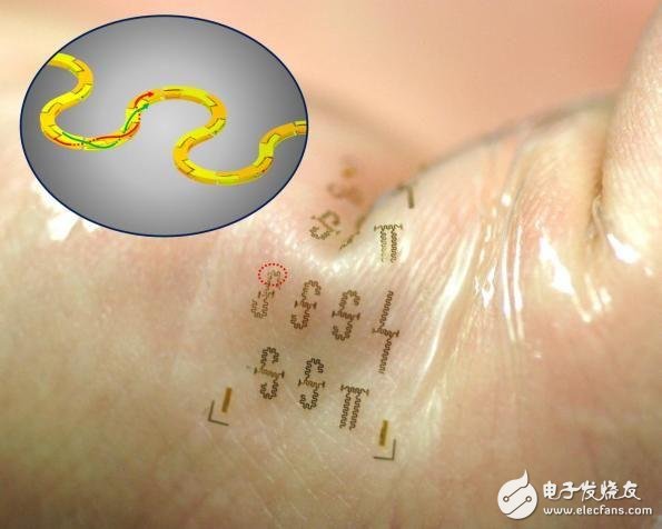 可穿戴集成电路可望推动物联网医疗应用